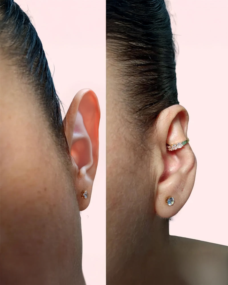 Orélina Ear Corrector Clip